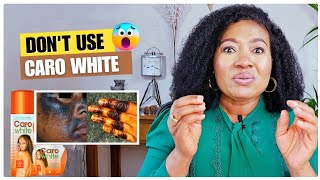 Caro White Bleaching Cream EXPOSEDSIDE EFFECTS Of Skin Bleaching [upl. by Cichocki]