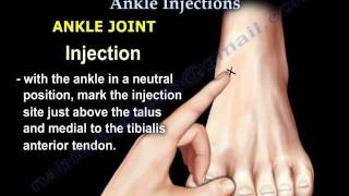 Common Foot And Ankle Injections  Everything You Need To Know  Dr Nabil Ebraheim [upl. by Wilfrid]