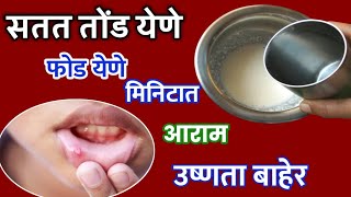 तोंड येणे दोन मिनिटात आराम घरगुती उपायtond yene gharguti upay in marathimouth ulcers treatment [upl. by Swart]