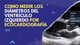 📌Como medir 📏 DIAMETROS DEL VENTRÍCULO IZQUIERDO por ECOCARDIOGRAFÍA [upl. by Genesia585]