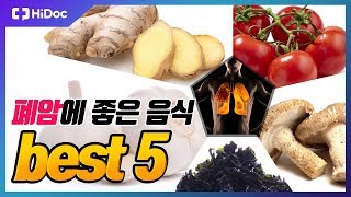 폐암에 좋은 음식 BEST5 건강정보 [upl. by Attelra]