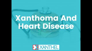 XANTHOMA AND HEART DISEASE  Brought To You By XANTHEL ® Easy Eyelid Xanthoma Removal [upl. by Olva]