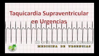 Taquicardia Supraventricular en Urgencias [upl. by Paulsen882]