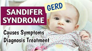 Sandifer Syndrome GERD Causes Symptoms Diagnosis amp Treatment  Hiatal Hernia  Pediatrics [upl. by Yrrab]