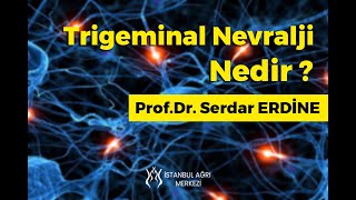 Trigeminal Nevralji Nedir [upl. by Libb]