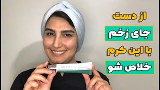 با این کرم از دست جای زخم، جای جوش، اسکار و استرچ مارک خلاص میشی پوستصاف پوستسالم پوستزیبا [upl. by Annaeirb942]