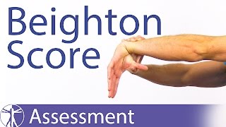 The Beighton Score  Generalized Joint Hypermobility Laxity [upl. by Gothurd]