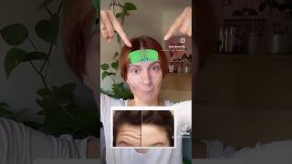 Forehead lines Watch this foreheadlines wrinkles facemassage facelifting faceyoga [upl. by Rennug]