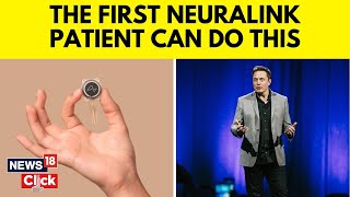 Neuralink News  Elon Musk  First Neuralink Patient Able to Control Mouse With Thoughts  N18V [upl. by Siger]