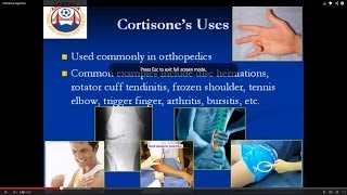 Your guide to cortisone injections [upl. by Cyndi]