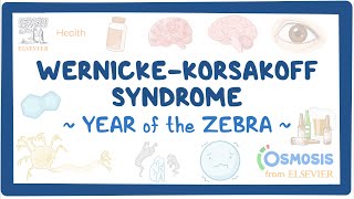 Wernicke Korsakoff Syndrome Year of the Zebra [upl. by Ytissahc]