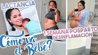 1 SEMANA POSTPARTO después de CESÁREA 👶 INFLAMACIÓN 🍼 LACTANCIA  ADAPTACIÓN [upl. by Paynter]