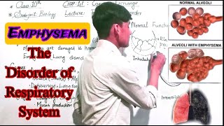 Emphysema  The disorder of Respiratory System Class 10th Biology [upl. by Koeppel]