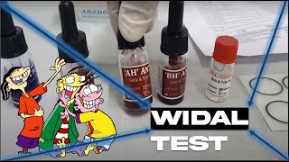 WIDAL TEST  SLIDE AGGLUTINATION TEST  TYPHOID FEVER  MICROBIOLOGY  MBBS  REVISION [upl. by Gracie]