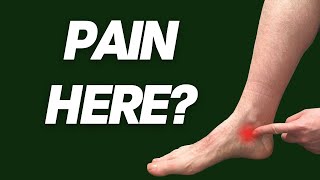 Posterior Tibial Tendon Dysfunction EVERYTHING YOU NEED TO KNOW  Inner Ankle Pain [upl. by Ecertap]