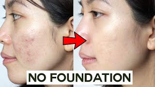 How to Cover Acne amp Blemishes WITHOUT Foundation • easy amp non cakey [upl. by Jeniece764]