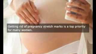 How To Remove Stretch Marks After Pregnancy [upl. by Saberio845]