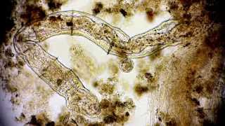 Nematode  Mikroorganismus  Microorganism  Nematoda  Fadenwurm im Wassertropfen microscope [upl. by Fitzhugh]