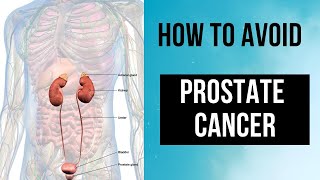 How to Prevent Prostate Cancer 7 Essential Tips [upl. by Vig223]