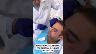 Hyaluronidase Enzyme for UnderEye Filler Removal  EDEN AESTHETICS Clinic Dubai [upl. by Dopp]