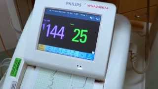 Baby Contraction verses Heart Rate monitor [upl. by Sundberg]