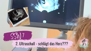 SSW 7  2Ultraschall  Schlägt das Herz 🥹  Mädchen oder Junge Ramzi Methode [upl. by Alek]