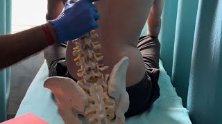 Posture correction in scoliosis patient by DrRavi [upl. by Wilbert]