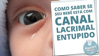 CANAL LACRIMAL ENTUPIDO E COMO TRATAR A OBSTRUÇÃO  MACETES DE MÃE [upl. by Kitrak567]