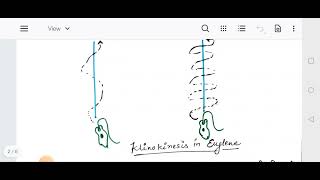 orientationkinesis and Taxis [upl. by Raamal65]