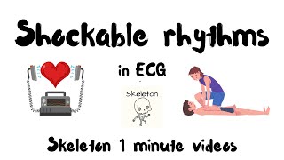 Shockable rhythms in ECG in 1 min  Skeleton ACLS shorts [upl. by Nirre]