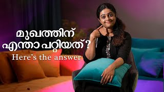 മുഖത്തിന് എന്താ പറ്റിയത് Here’s the answer  Aswathy Sreekanth  Life Unedited aswathysreekanth [upl. by Nuahc]