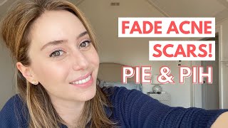 How To Fade Acne Scars Post Inflammatory Erythema amp Post Inflammatory Hyperpigmentation [upl. by Sidnee]