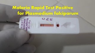 How to use RAPID TEST KIT AT HOME [upl. by Emmaline]