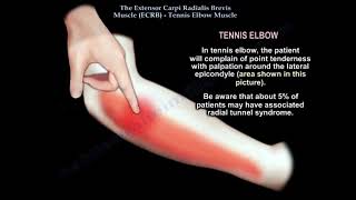 Tennis Elbow Clinical and Anatomical Considerations The tennis elbow muscle [upl. by Artimas]