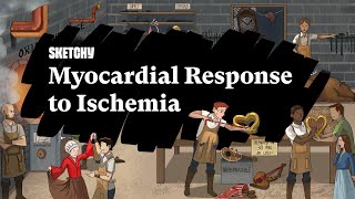 Myocardial Response to Ischemia Causes and Effects Part 1  Sketchy Medical  USMLE Step 1 [upl. by Aicilanna30]