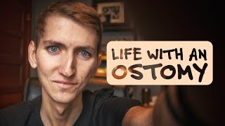 Living With An Ostomy [upl. by Alten]