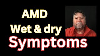 😎 Macular Degeneration Symptoms AMD Wetb amp Dry [upl. by Sweet]