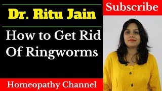 How To Get Rid of Ringworms  Ringworm Treatment  दाद का इलाज [upl. by Ardelle102]