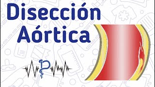 Disección Aórtica  APH Manabí [upl. by Erodoeht]