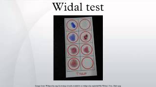 Widal test [upl. by Ahsemat690]