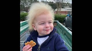 Boy With Rare Uncombable Hair Syndrome Brings a Smile to Faces [upl. by Litman]