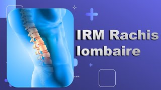 IRM du Rachis lombaire Bonne Pratique [upl. by Eesdnil]