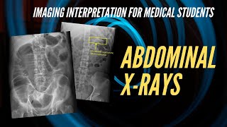 Abdominal Xray Interpretation for Medical Students [upl. by Ulberto]