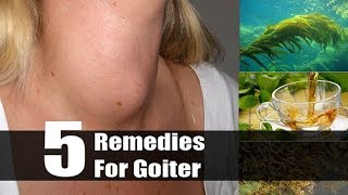 5 Useful Home Remedies For Goiter  By Top 5 [upl. by Maryanna]