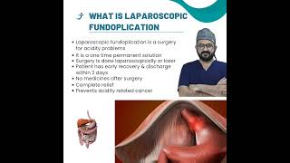 Understanding  what is fundoplication [upl. by Nirrad]