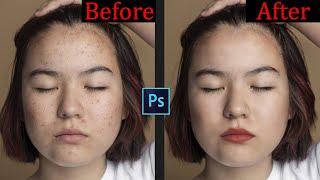 Fastest way to clean your face in photoshop  pimples blemishes acne  Adobe Photoshop Tutorial [upl. by Violet]