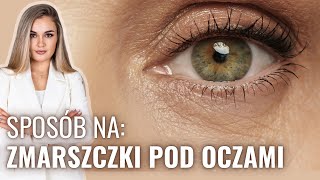 ❤️NAJLEPSZE SPOSOBY NA ZMARSZCZKI POD OCZAMI  DIETA ZABIEGI SEN PIELĘGNACJA I WIELE INNYCH [upl. by Aicenod]