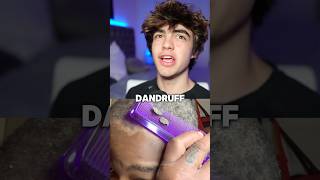 How to get rid of dandruff 😱🤝 [upl. by Riane444]