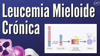 Leucemia Mieloide Crónica [upl. by Merna]