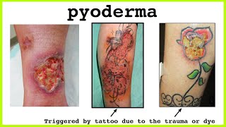 pyoderma [upl. by Clevey872]